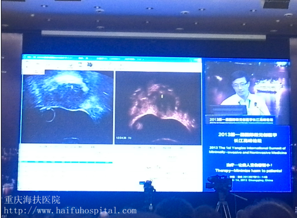 Ultrasonography image contrast before and after 